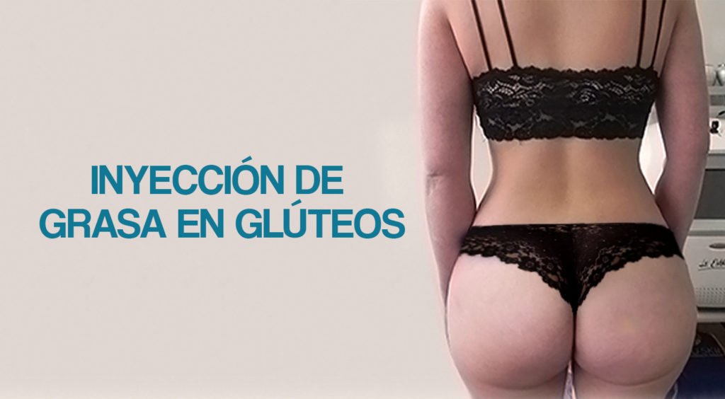 Inyección de Grasa en Glúteos: ¿Es recomendado? ¿Qué riesgos tiene?