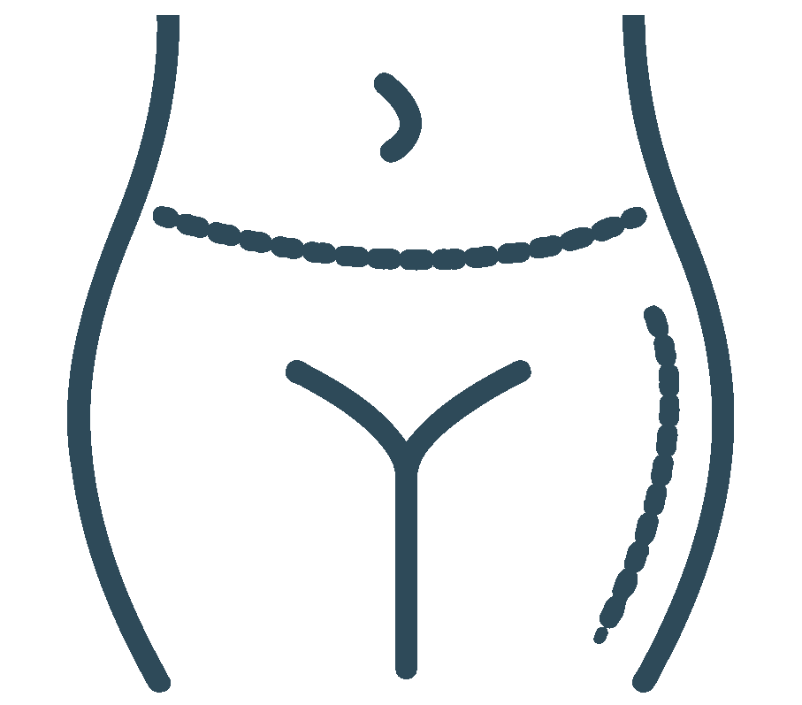 cirugia de Lipoescultura láser en bogotá