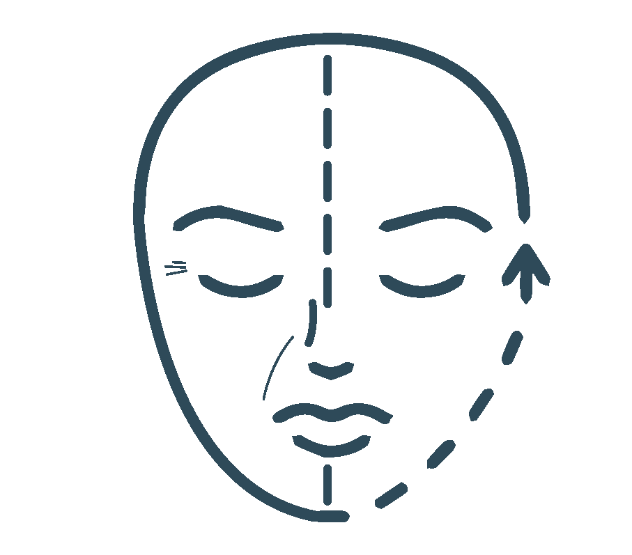 cirugia de Ritidoplastia o lifting facial en bogotá