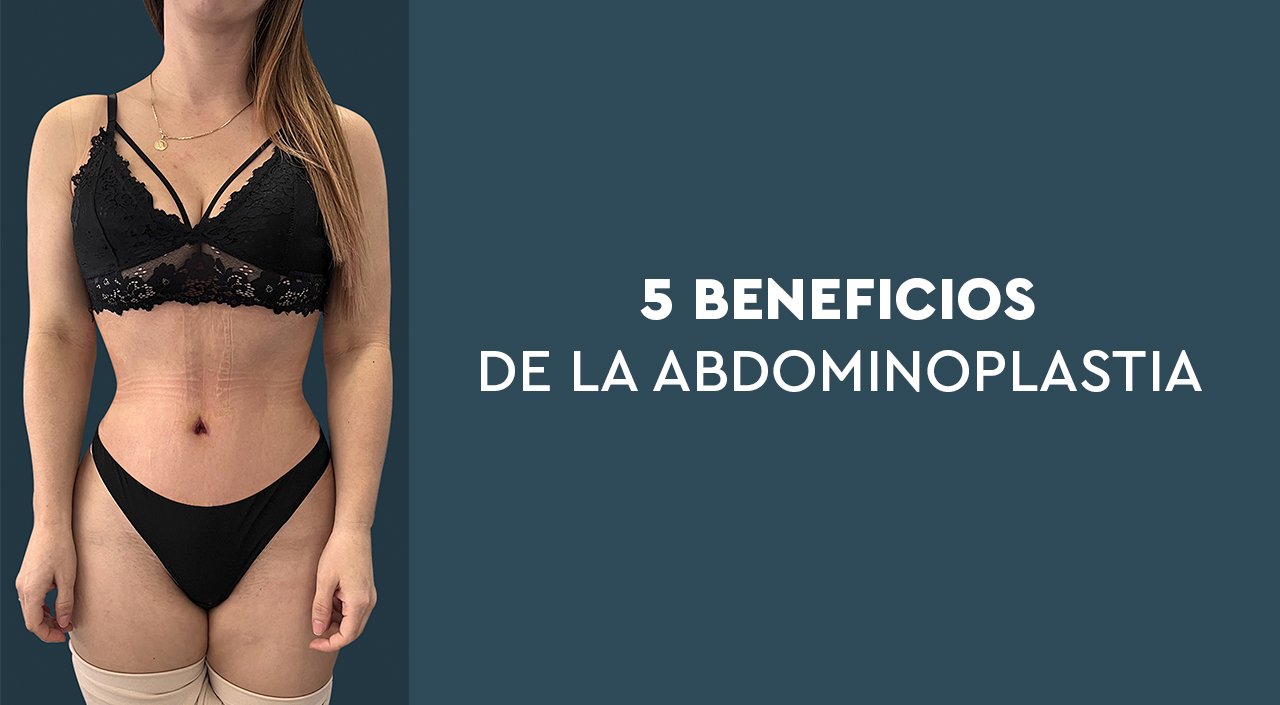5 Beneficios de la abdominoplastia