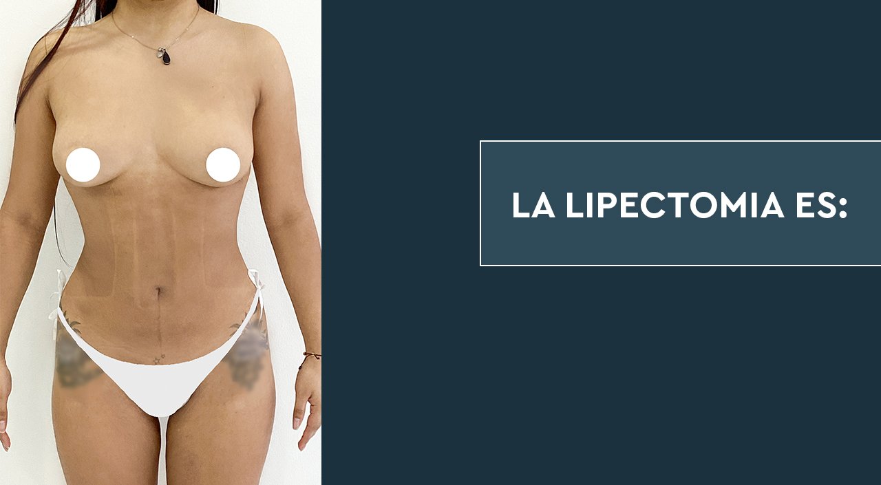 Que es la Lipectomia