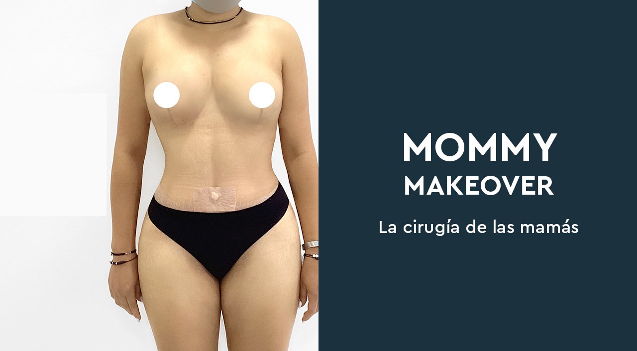 Mommy Makeover – Todo lo que debes saber